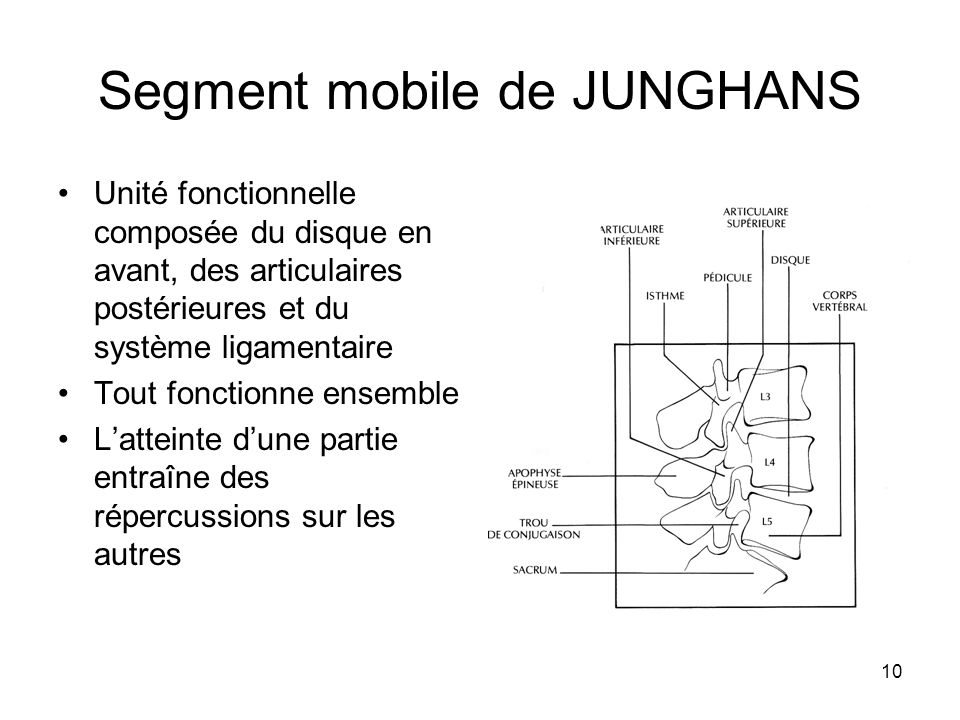 RADICULALGIES. ppt video online t l charger